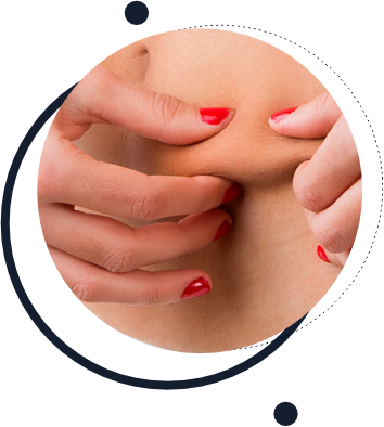 Abdominoplastia Abdominoplastia