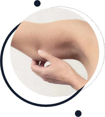 Braquioplastia
