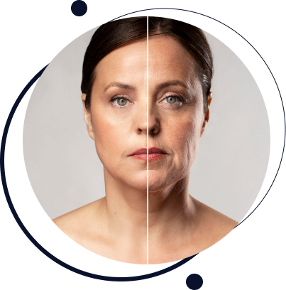 Lifting Facial Lifting Facial
