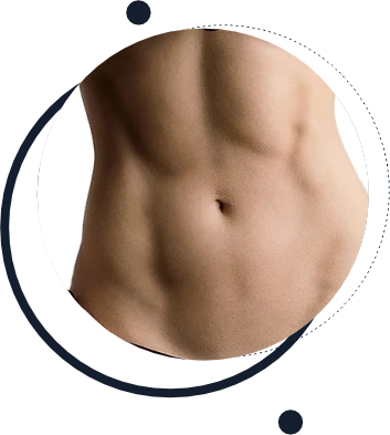 Lipoaspiração no abdome Lipoaspiração no abdome