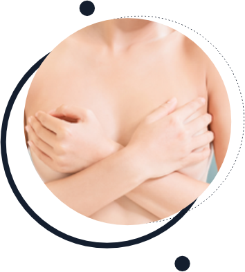 Mastopexia Short Scar Mastopexia Short Scar