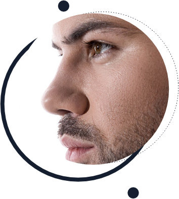 Rinoplastia Masculina